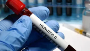 England Hepatitis C Ke Khatme Ke Qareeb Pahoanch Gaya